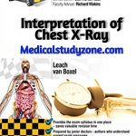 Crash Course Interpretation of Chest X-Ray PDF Free Download