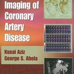 Diagnostic Imaging of Coronary Artery Disease CHM PDF Free Download