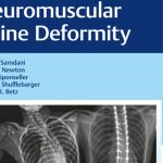 Neuromuscular Spine Deformity 1st Edition PDF Free Download