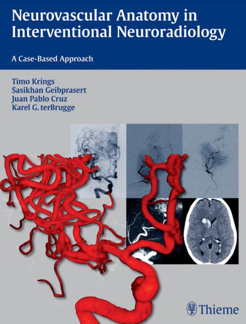 Neurovascular Anatomy in Interventional Neuroradiology PDF Free Download