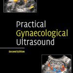 Practical Gynaecological Ultrasound 2nd Edition PDF Free Download