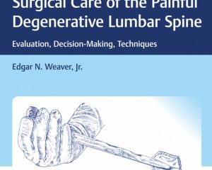 Surgical Care of the Painful Degenerative Lumbar Spine 1st Edition PDF Free Download