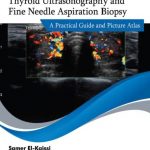 Thyroid Ultrasonography and Fine Needle Aspiration Biopsy PDF Free Download