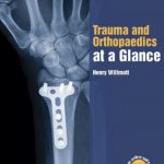 Trauma and Orthopaedics at a Glance PDF Free Download