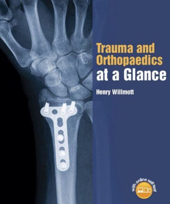 Trauma and Orthopaedics at a Glance PDF Free Download