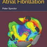 Understanding Atrial Fibrillation PDF Free Download