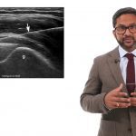 MSK Ultrasound Guided Injections MasterClass 2020 Free Download