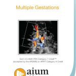 Multiple Gestations 2020 Free Download