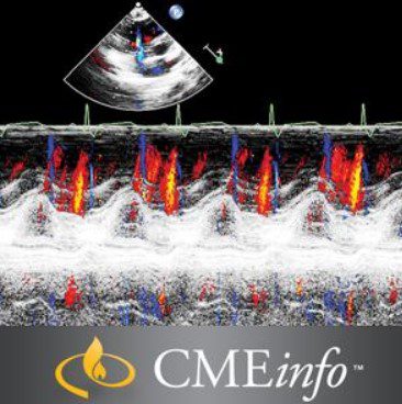 Oakstone CME Echocardiography A Comprehensive Review 2020 Free Download