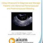 Using Ultrasound to Diagnose and Manage Patients with Abnormal Premenopausal and Postmenopausal Bleeding Free Download