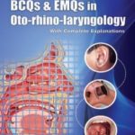 BCQs & EMQs in Oto-Rhino-Laryngology Iqbal Hussain Udaipurwala PDF Free Download