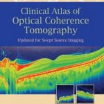 Clinical Atlas of Optical Coherence Tomography Muhammad Moin PDF Free Download