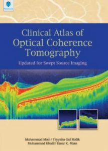 Clinical Atlas of Optical Coherence Tomography Muhammad Moin PDF Free Download
