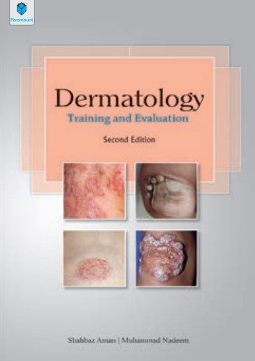 Dermatology Training and Evaluation 2nd Edition By Shahbaz Aman PDF Free Download