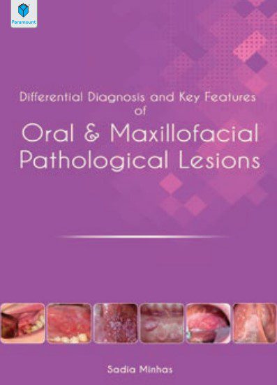 Differential Diagnosis and Key Features of Oral & Maxillofacial Pathological Lesions Sadia Minhas PDF Free Download