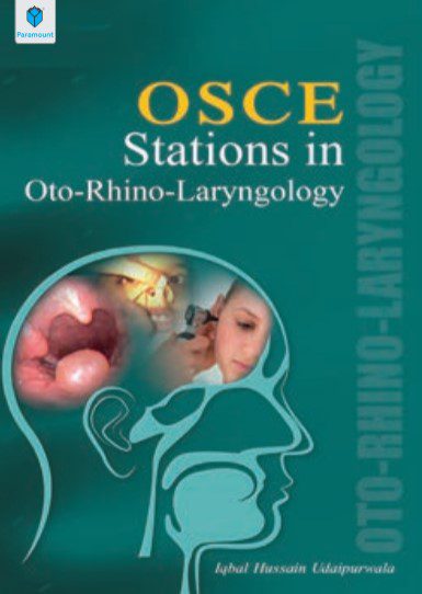 OSCE Stations in Oto-Rhino-Laryngology Iqbal Hussain Udaipurwala PDF Free Download