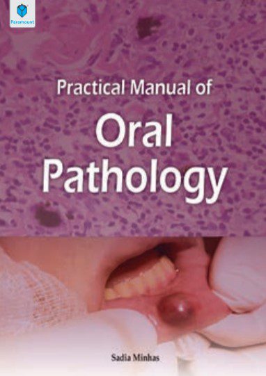 Practical Manual of Oral Pathology By Sadia Minhas PDF Free Download