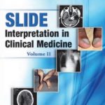 Slide Interpretation in Clinical Medicine Volume II By Farrukh Iqbal PDF Free Download