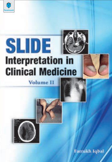 Slide Interpretation in Clinical Medicine Volume II By Farrukh Iqbal PDF Free Download