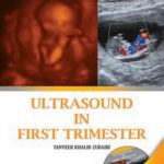 Ultrasound in First Trimester By Tanveer Khalid Zubairi PDF Free Download