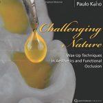 Challenging Nature Wax up Technique PDF Free Download