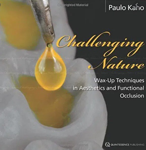 Challenging Nature Wax up Technique PDF Free Download