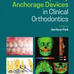 Temporary Anchorage Devices in Clinical Orthodontics PDF Free Download