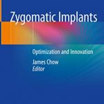 Zygomatic Implants Optimization and Innovation PDF Free Download