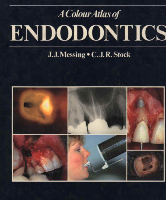 A Colour Atlas of Endodontics PDF Free Download
