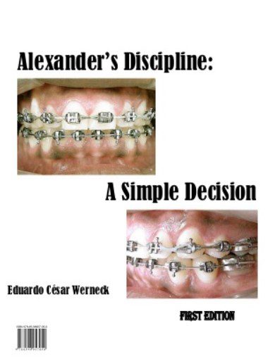 Alexanders Discipline A Simple Decision PDF Free Download