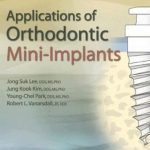 Applications of Orthodontic Mini-Implants PDF Free Download