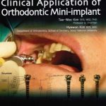 Clinical Application of Orthodontic Mini-implant PDF Free Download