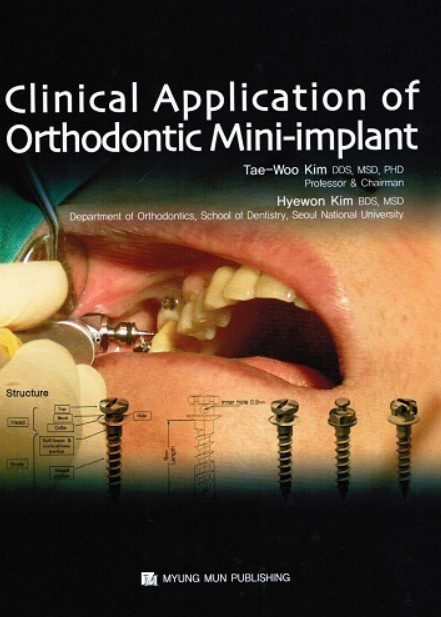 Clinical Application of Orthodontic Mini-implant PDF Free Download