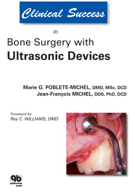 Clinical Success in Bone Surgery With Ultrasonic Devices PDF Free Download