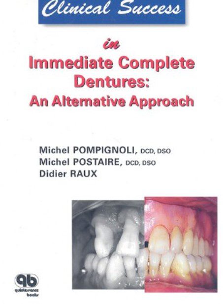 Clinical Success in Immediate Complete Denture PDF Free Download