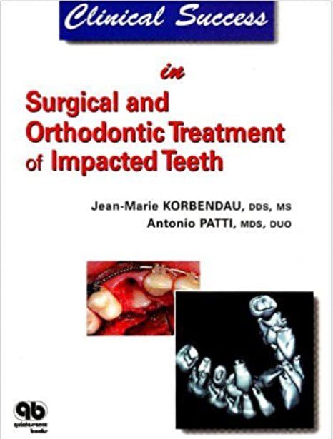 Clinical Success in Surgical and Orthodontic Treatment of Impacted Teeth PDF Free Download