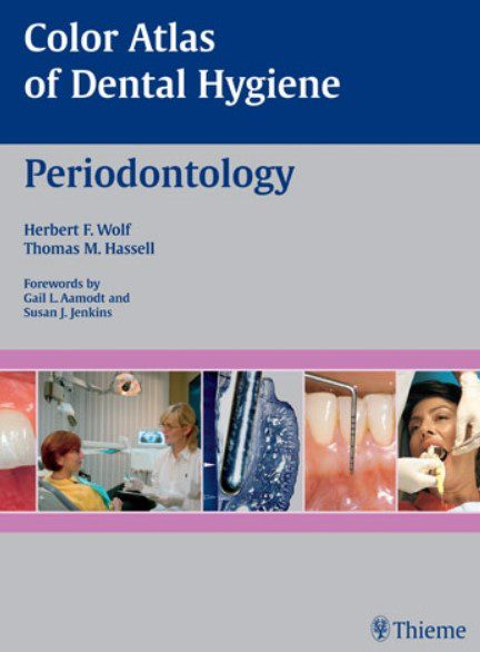 Color Atlas of Dental Hygiene Periodontology PDF Free Download