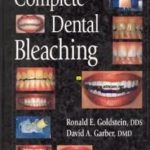 Complete Dental Bleaching PDF Free Download