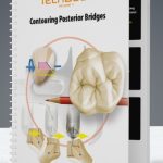 Contouring Posterior Bridges PDF Free Download
