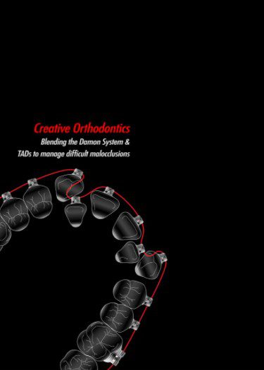 Creative Orthodontics Blending The Damon System PDF Free Download