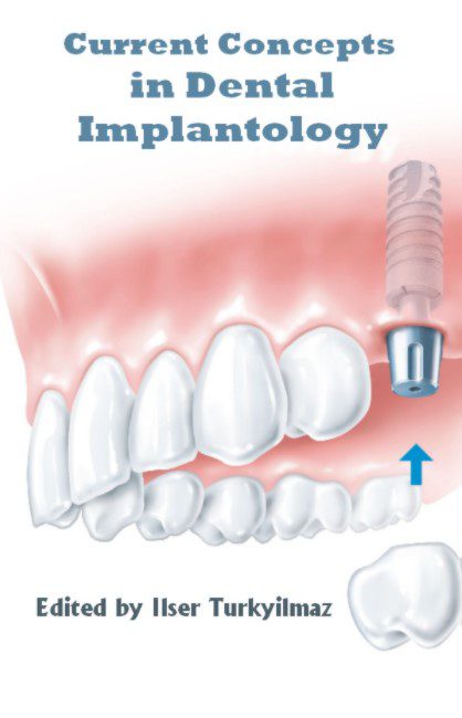 Current Concepts in Dental Implantology PDF Free Download
