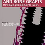 Dental Implants and Bone Grafts PDF Free Download