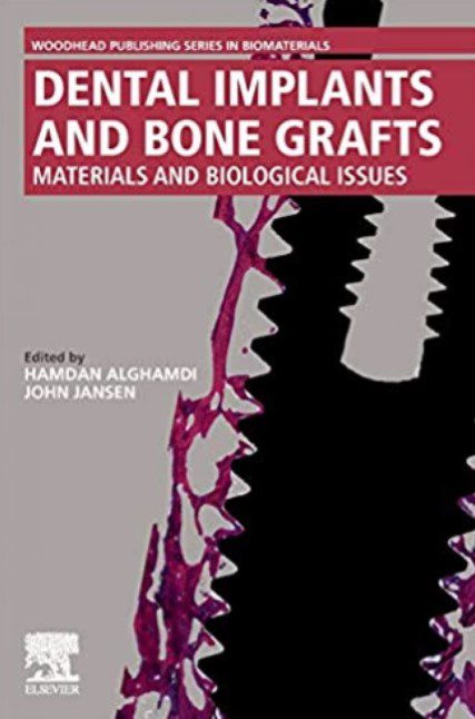 Dental Implants and Bone Grafts PDF Free Download