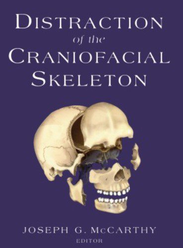 Distraction of the Craniofacial Skeleton PDF Free Download