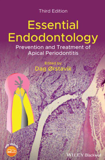 Essential Endodontology PDF Free Download