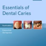 Essentials of Dental Caries 4th Edition PDF Free Download
