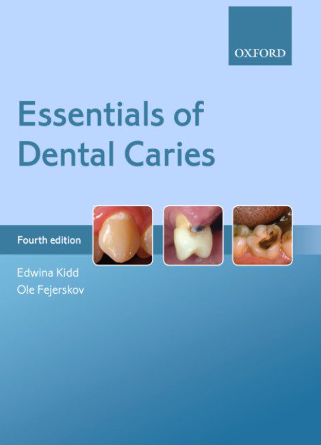 Essentials of Dental Caries 4th Edition PDF Free Download
