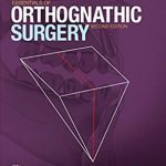 Essentials of Orthognathic Surgery 2nd Edition PDF Free Download