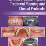 Evidence-based Implant Treatment Planning and Clinical Protocols PDF Free Download