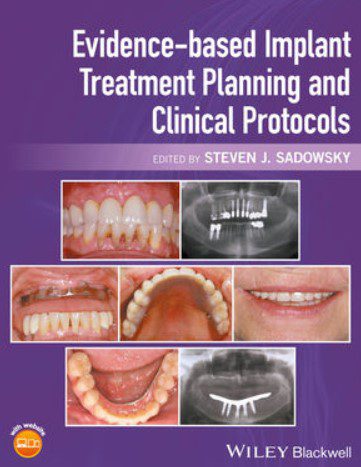 Evidence-based Implant Treatment Planning and Clinical Protocols PDF Free Download
